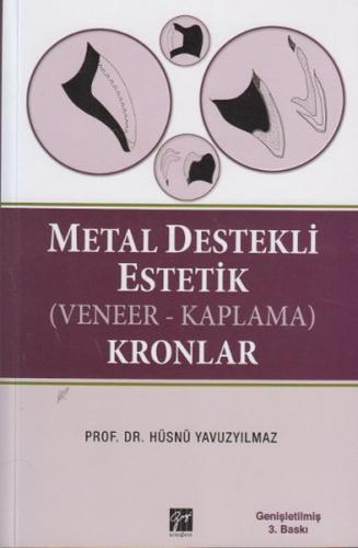 Metal Destekli Estetik (Veneer-Kaplama)Kronlar (Ciltli) - Hüsnü Yavuzy