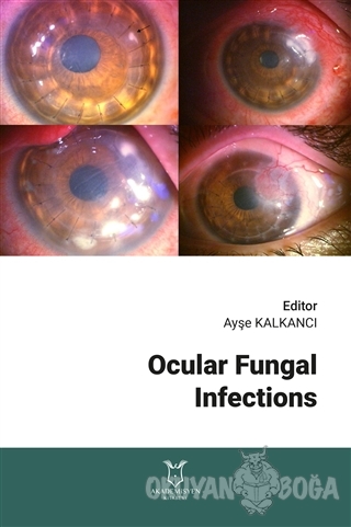 Ocular Fungal Infections - Ayşe Kalkancı - Akademisyen Kitabevi